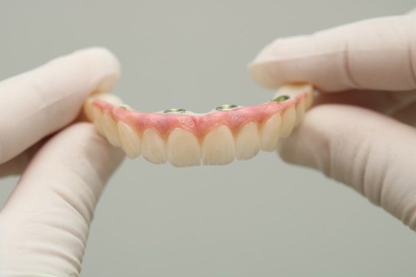 Reasons To Consider All On  ® Teeth Replacement