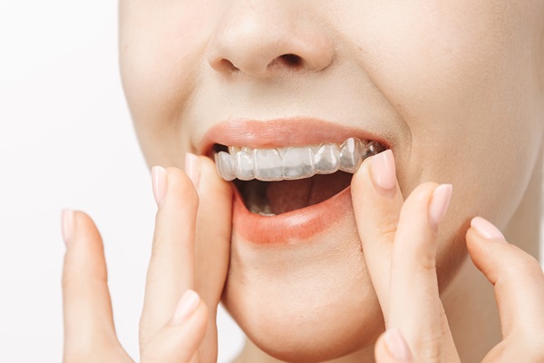 How Long Do I Need To Wear ClearCorrect Braces?